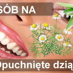 Opuchnięte dziąsła: Szybka ulga i skuteczne sposoby (domowe i apteczne)