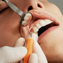 Dentysta wykonuje czyszczenie zębów u pacjenta, używając lusterka i narzędzia.
