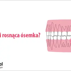 Ósemki: Kiedy rosną? Objawy, ból i kiedy iść do dentysty