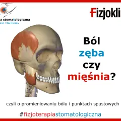 Anatomia czaszki z zaznaczonym mięśniem skroniowym. Czy to tępy ból zęba czy mięśnia? #fizjoterapiastomatologiczna