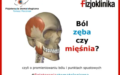 Anatomia czaszki z zaznaczonym mięśniem skroniowym. Czy to tępy ból zęba czy mięśnia? #fizjoterapiastomatologiczna