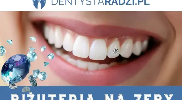 Uśmiech z błyszczącym kolczykiem na zębie. Biżuteria na zęby dodaje blasku.