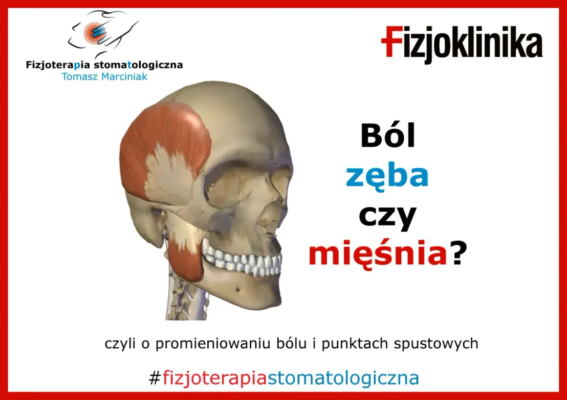 Anatomia czaszki z zaznaczonym mięśniem skroniowym. Czy to tępy ból zęba czy mięśnia? #fizjoterapiastomatologiczna