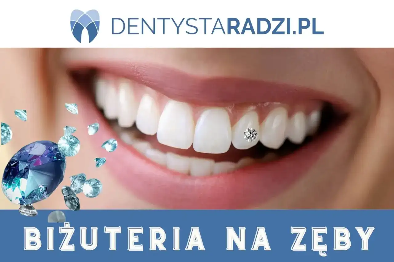 Biżuteria nazębna - czy warto i ile kosztuje ozdoba na zębie?
