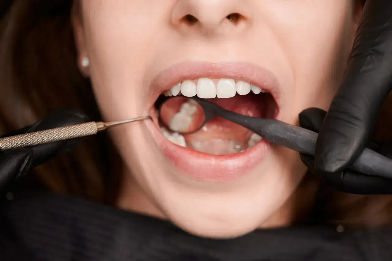 Dentysta bada zęby mądrości, podejrzewając stan zapalny.