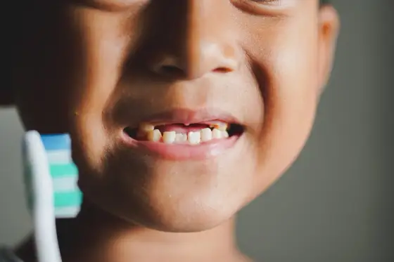 Szary ząb u dziecka - Co oznacza i kiedy do dentysty?