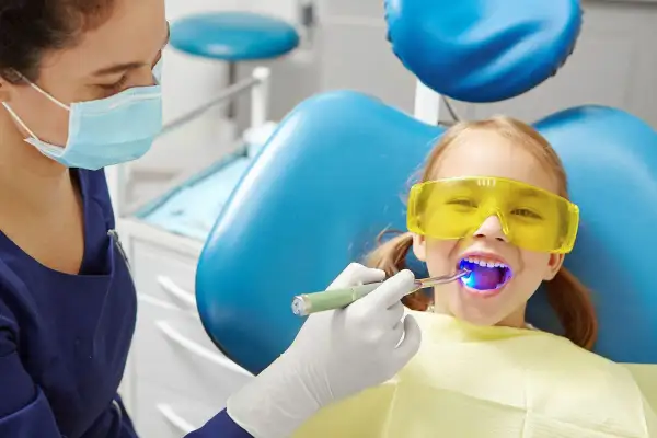 Dziecko w okularach ochronnych uśmiecha się, gdy dentystka utwardza lakowanie zębów. Czy lakowanie zębów jest szkodliwe? Nie, to bezpieczna profilaktyka.