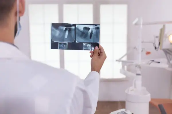 Dentysta analizuje RTG, by sprawdzić, ile kanałów ma ząb 7 dolny. Widać implant.