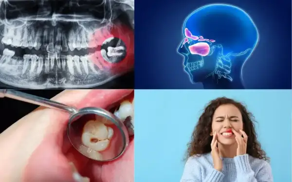 RTG szczęki, zatoki, ząb w lustrze dentystycznym i kobieta z bólem zęba. Jak uśmierzyć ból rosnący ząb mądrości?